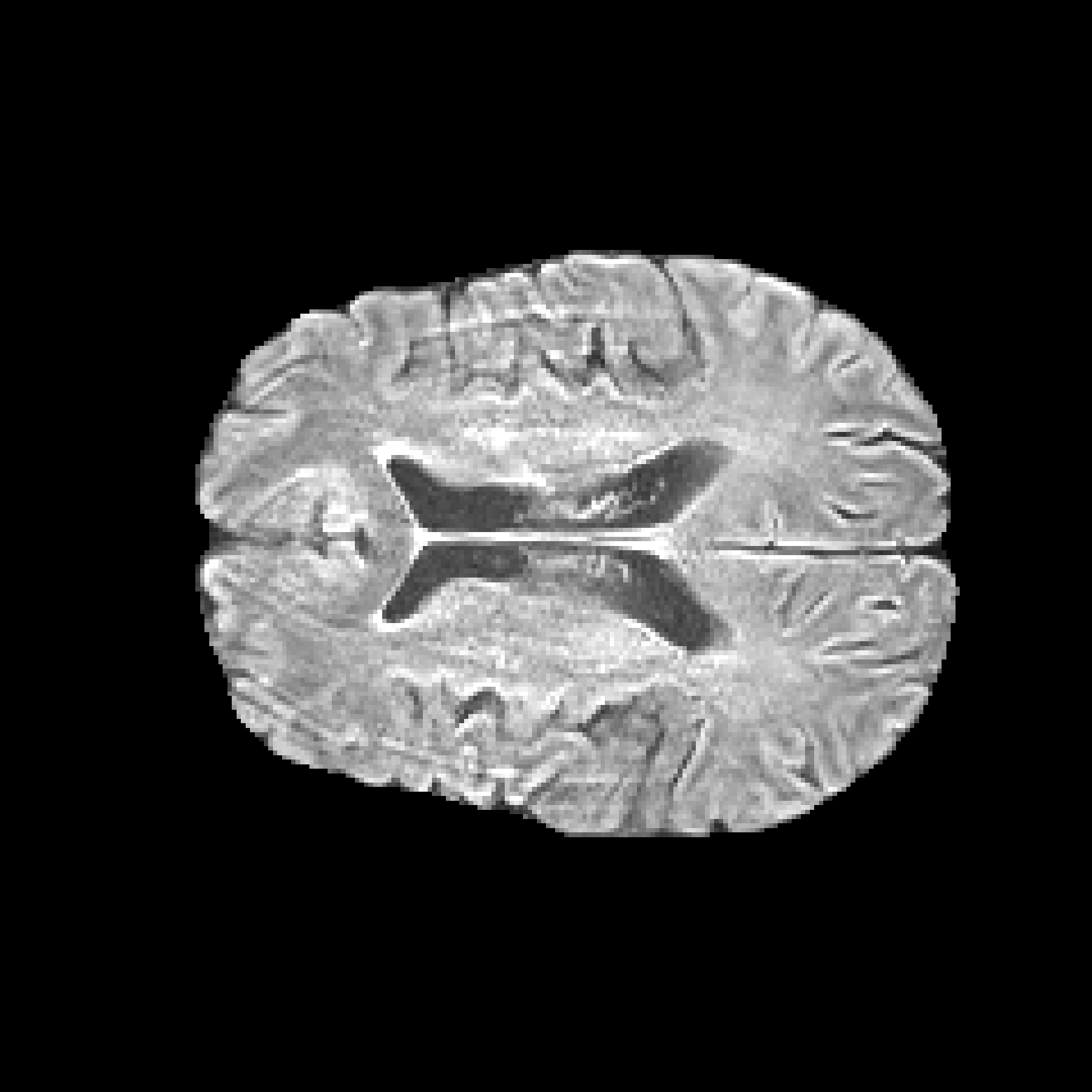 Synthetic MRI Brain Scan 1