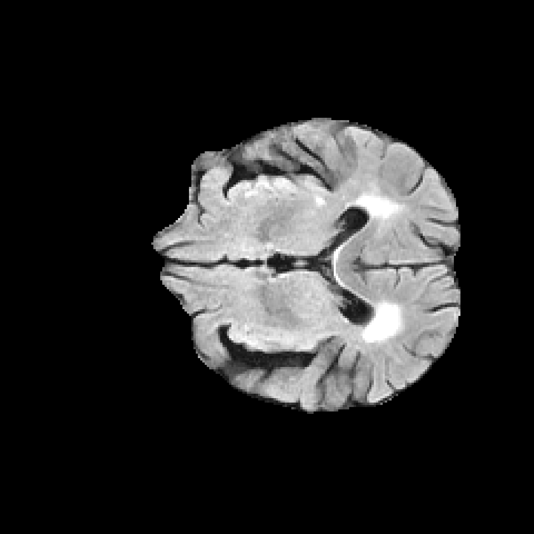 Synthetic MRI Brain Scan 2