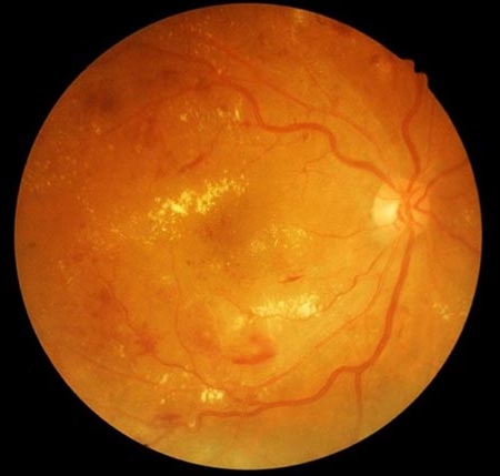 Synthetically generated retinal fundus image showing detailed vasculature and optic disc
